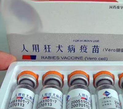 狗咬潛伏期多長時(shí)間_被家狗咬后一般潛伏期多長時(shí)間_潛伏期的狗咬人會(huì)傳染嗎
