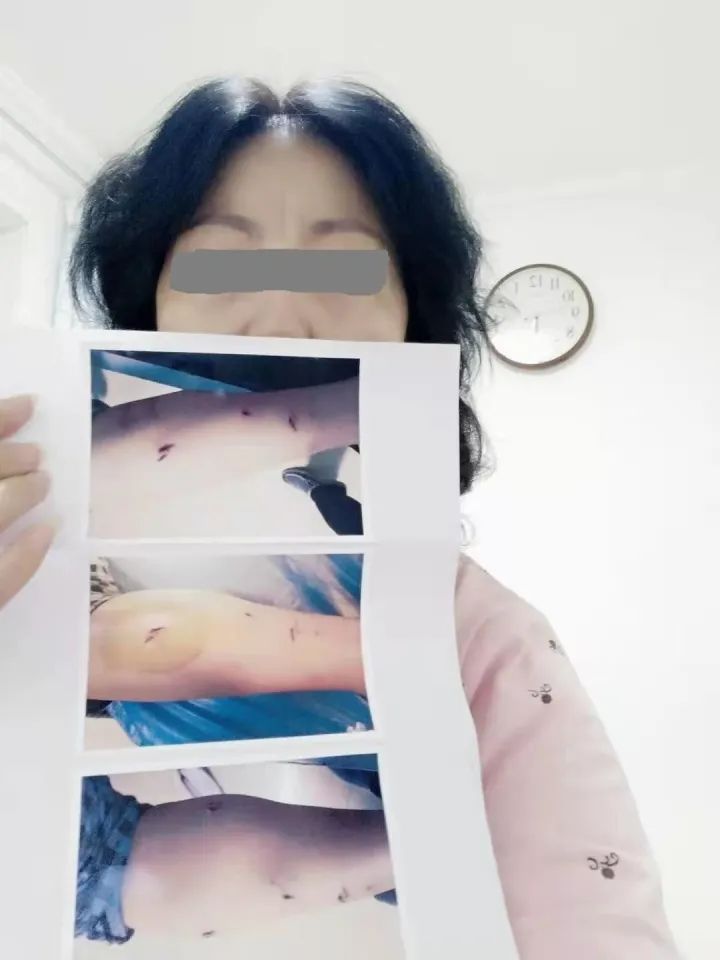 狂犬疫苗狗_給狗接種狂犬疫苗_狗狂犬疫苗多少錢